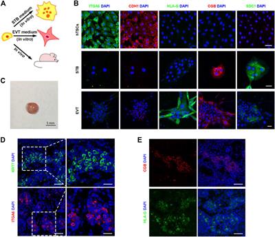 LMNA Determines Nuclear Morphology During Syncytialization of Human Trophoblast Stem Cells